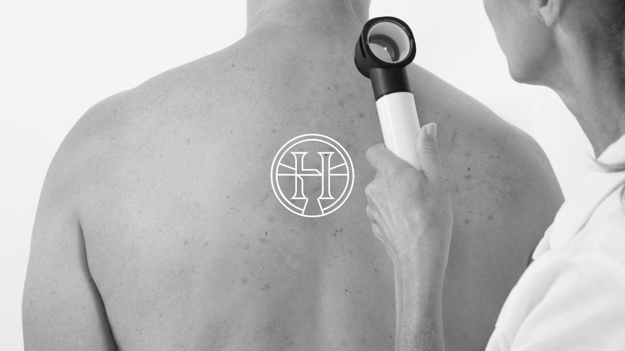 Back Acne Treatment NYC | Alinea Medical Spa, image size:1280x720